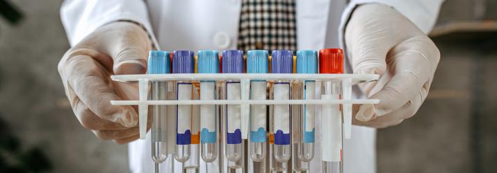 Il punto sulle varianti coronavirus in Italia Il punto sulle varianti coronavirus in Italia