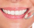 Denti bianchi: sbiancamento fai da te e professionale