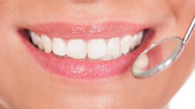 denti bianchi sbiancamento fai da te e professionale