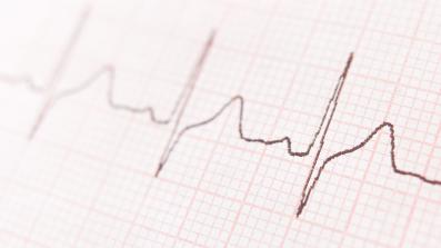 conseguenze e trattamenti per la fibrillazione atriale