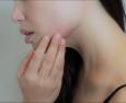Maskne: come curare l'acne da mascherina