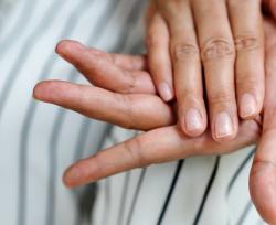 Malattie delle unghie, come si riconoscono