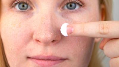 Pelle secca in inverno: cosa fare per proteggerla dal freddo?