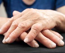 Artrite e artrosi, qual è la differenza