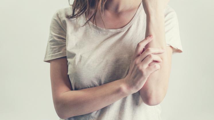Cure naturali per la psoriasi