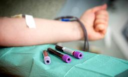 Donazione di sangue: cosa fare prima e dopo il prelievo
