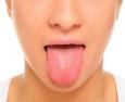 Lingua gialla: tutte le cause e alcuni rimedi