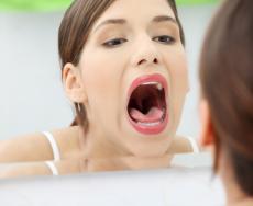 Afte alla lingua: cause, sintomi e terapie
