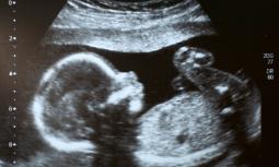 Medici obiettori di coscienza e aborto