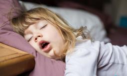 Terapia ortodontica per le apnee notturne nei bambini
