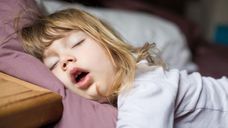 Terapia ortodontica per le apnee notturne nei bambini