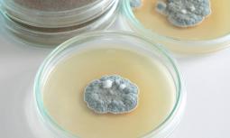 Penicillina: il primo antibiotico scoperto da Alexander Flaming