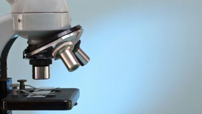 microscopio storia di un invenzione rivoluzionaria