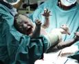 Morire di parto: i fattori di rischio