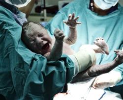 Morire di parto: i fattori di rischio