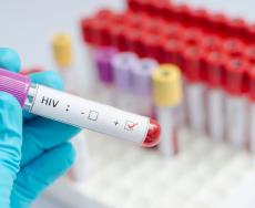 Test da fare per la diagnosi di HIV
