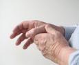 Sviluppo, diagnosi e trattamento dell'artrite reumatoide