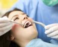 Carie dentaria: come si presenta e come si previene