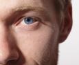 Cheratocono: la malattia degenerativa ed evolutiva della cornea