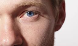 Cheratocono: la malattia degenerativa ed evolutiva della cornea