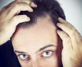 Definizione e classificazione delle alopecie