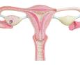 Displasia cervicale: quali sono i fattori di rischio e come si cura