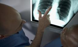 Embolia polmonare: sintomi e terapie