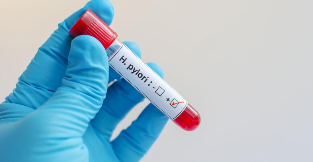 Infezione da Helicobacter Pylori: quali sono i sintomi?