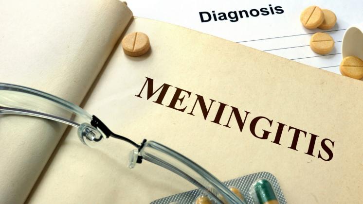 Meningite, cause e sintomi