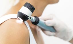 Nevi: cosa sono e come riconoscerli 