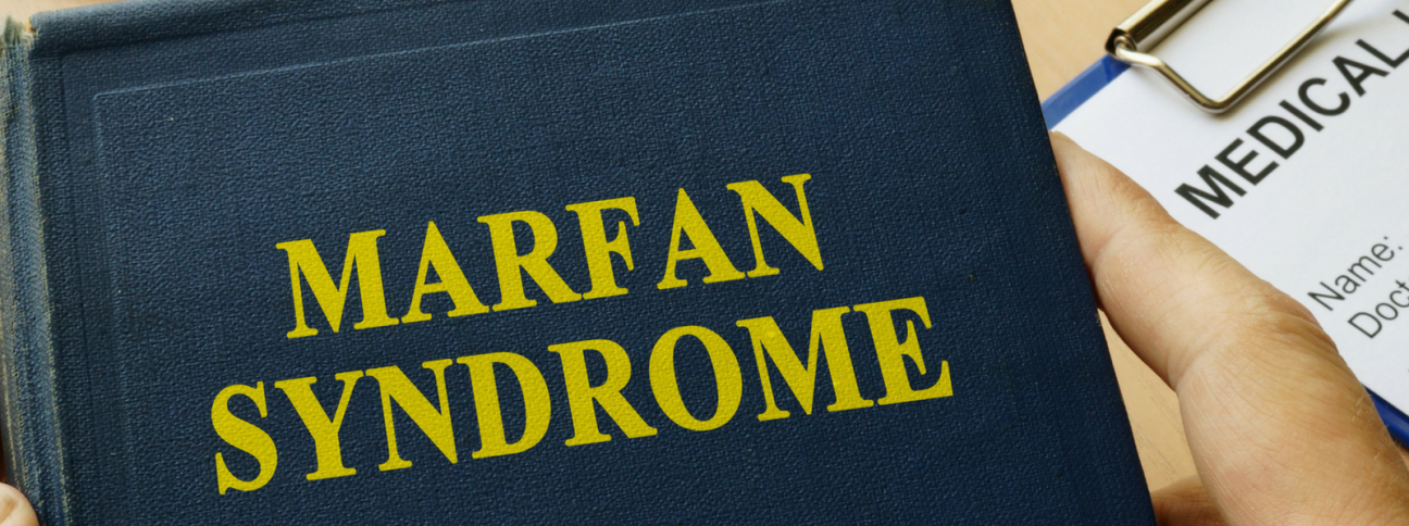Sindrome di Marfan: cosa sapere