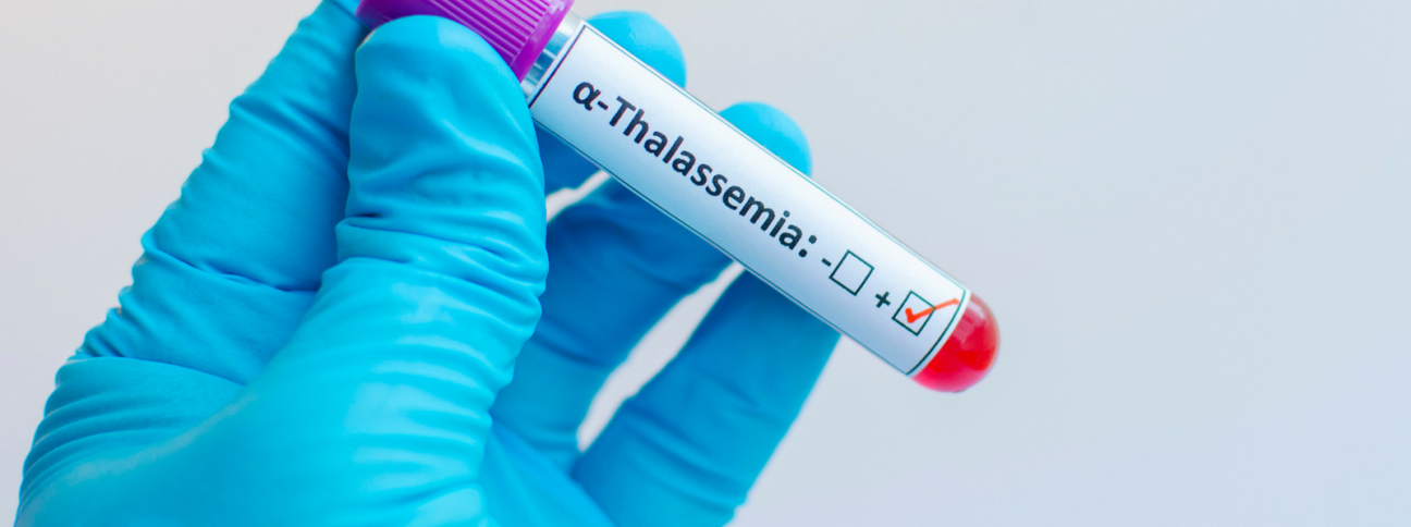 Talassemia o anemia mediterranea: che cos'è?