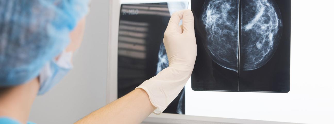 A cosa serve la mammografia? A cosa serve la mammografia?