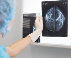 A cosa serve la mammografia?