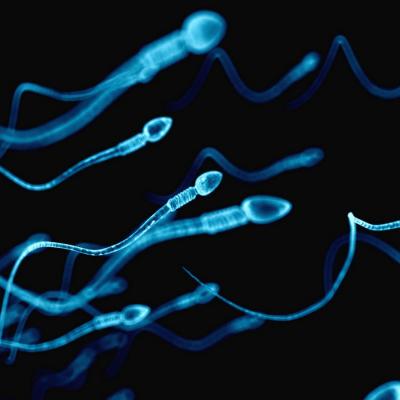 Spermiogramma: a che cosa serve l'analisi del liquido seminale -  Paginemediche