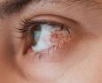 Malattie dell'occhio e ossigeno-ozonoterapia