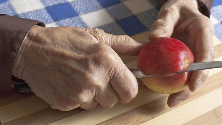 Artrite reumatoide, fibromialgia, osteoporosi: a ciascuno la sua dieta