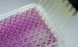 Cellule geneticamente modificate per contrastare i tumori
