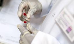 Epatite C, niente più casi in Europa dal 2030