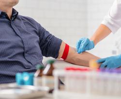 Un nuovo esame del sangue per la diagnosi di tumore alla prostata