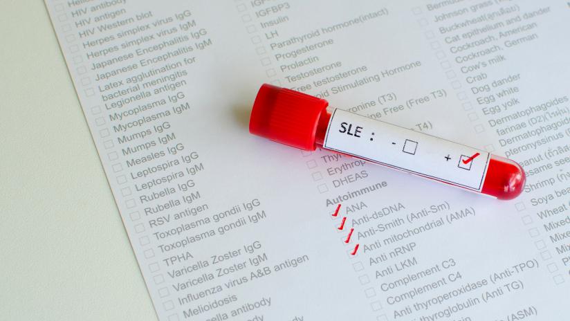 gratis herpes incontri siti recensioni