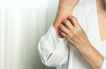 I sintomi del Covid sulla pelle: ecco a cosa fare attenzione