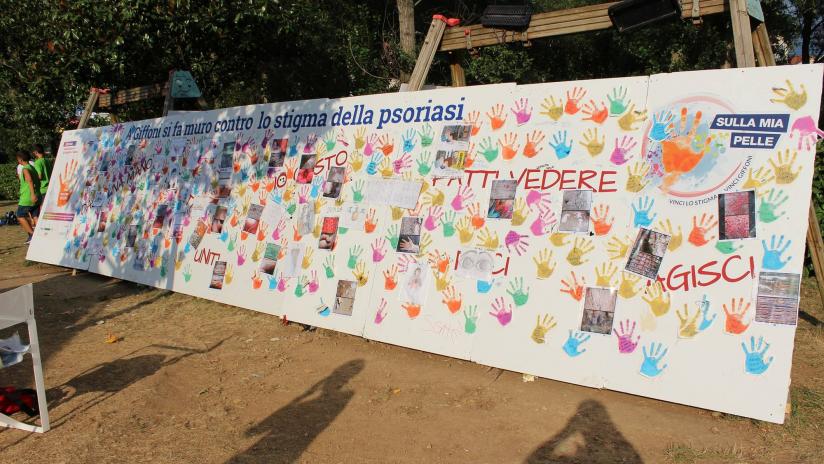 /news-ed-eventi/insieme-per-vincere-lo-stigma-della-psoriasi/insieme-per-vincere-lo-stigma-della-psoriasi.jpg /news-ed-eventi/insieme-per-vincere-lo-stigma-della-psoriasi/insieme-per-vincere-lo-stigma-della-psoriasi.jpg