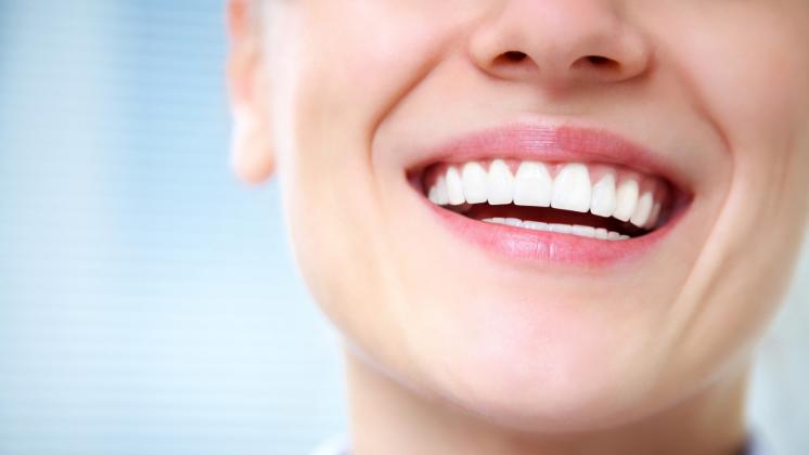 L'importanza della salute orale: il mese dedicato alla prevenzione dentale