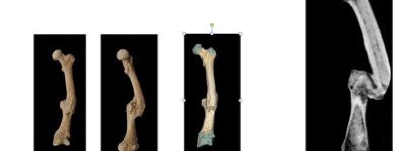 Medicina: 'Bones', 2.000 scheletri di antichi romani svelano acciacchi ossa