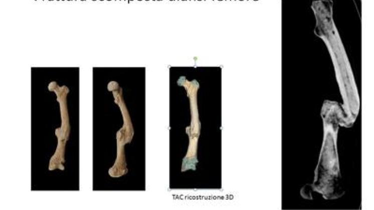 Medicina: 'Bones', 2.000 scheletri di antichi romani svelano acciacchi ossa