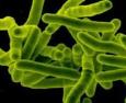 Medicina: in Usa primo caso batterio 'invincibile', resistente a tutti antibiotici