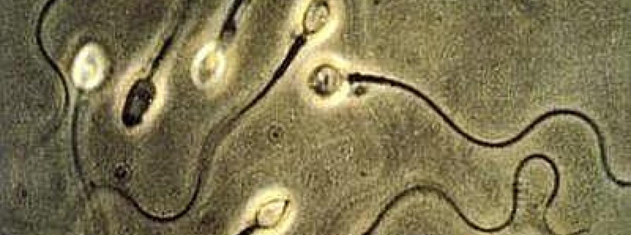 Ricerca: così lo spermatozoo mette 'il turbo', verso pillola unisex