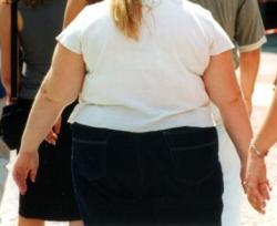 Salute: memoria degli obesi fa 'cilecca', più elastica quella dei magri