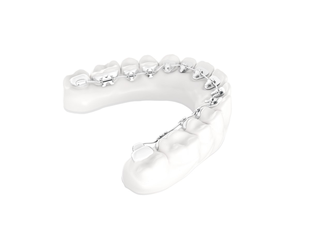 10 Bottoni Linguali Ortodontici Ovali Incollabili, Marca SmileOrtho, Per Archwire E Bande Molari